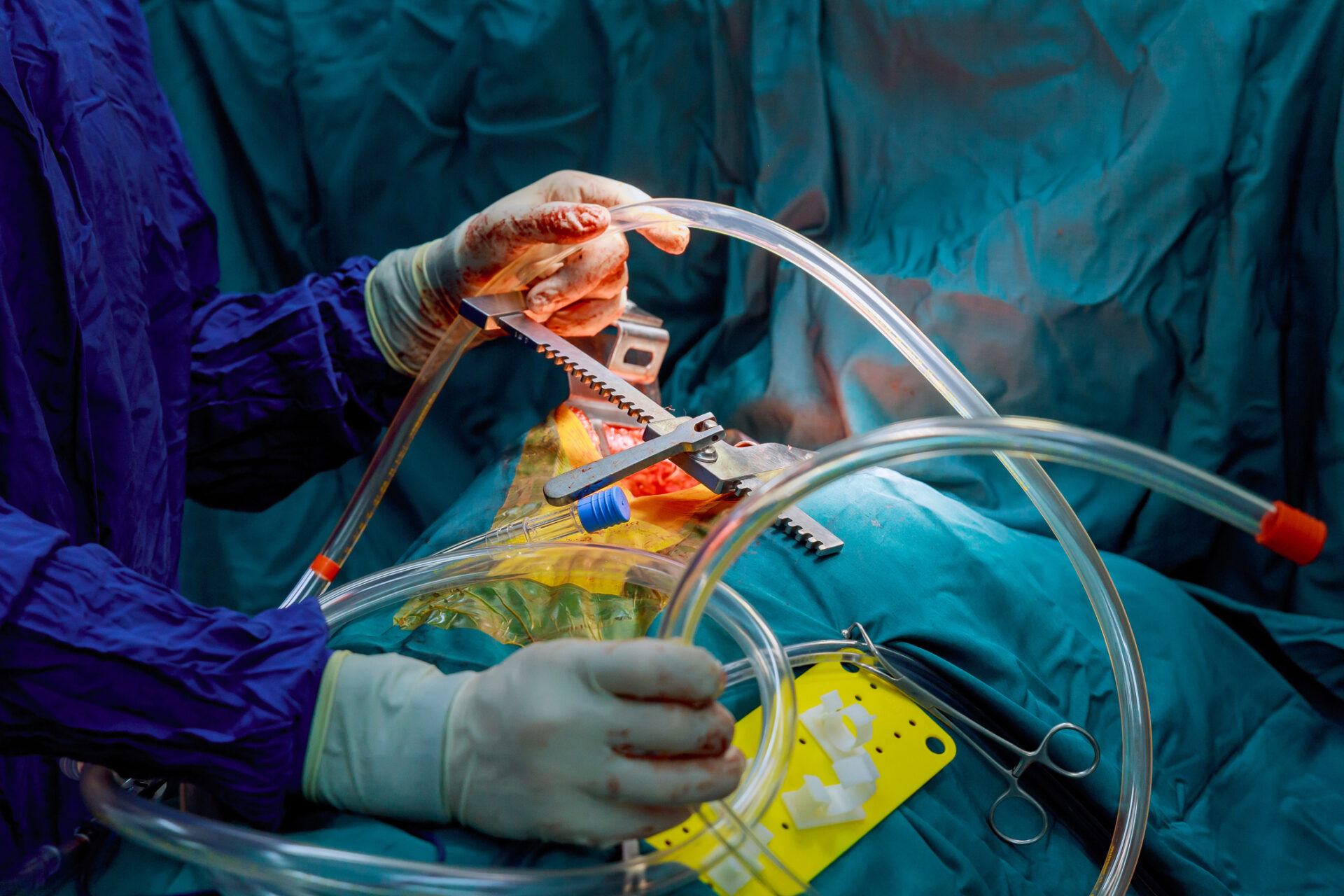 Training in cardiothoracic surgery is long, but residency programs are offering new pathways to help overcome the shortage.